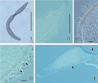 Detection of Prokaryotes on the Astomatous Ciliated Protist Kentrophoros flavus (Ciliophora, Karyorelictea) Revealed A Consistently Associated Muribaculaceae-Like Bacterium
